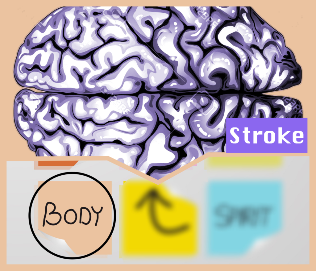 Stroke Rehabilitation