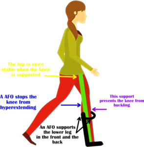 ankle foot orthosis diagram