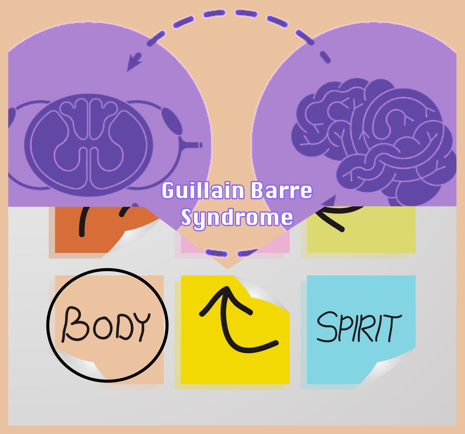 Essential Facts about Guillain Barre Syndrome | Orlando ...